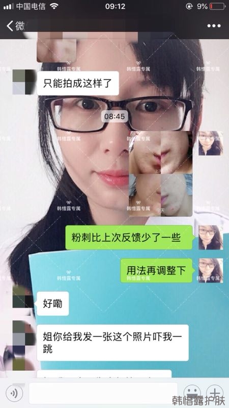 粉刺多怎么辦？按照要求配套耐心使用，粉刺消下去不少！