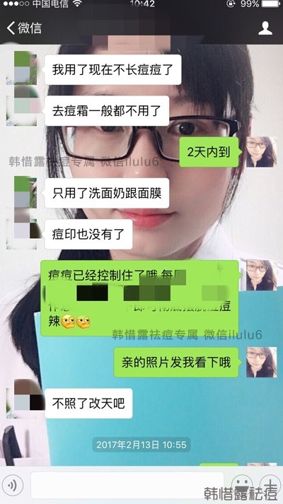 痘痘好了，再也沒有長過，懷孕8個月了！