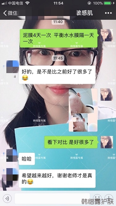 粉刺、痘痘、痘印、統(tǒng)統(tǒng)解決啦！祛痘去粉刺就是這么簡單！