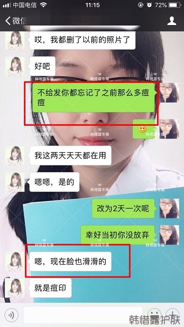 膿包痘祛痘效果，擁有干凈的臉不等待！