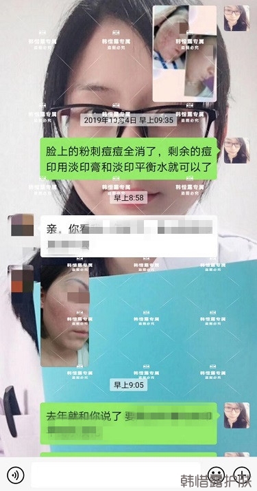 祛痘消炎水效果