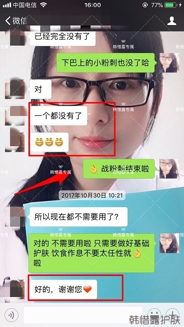 粉刺密密麻麻，試過很多方法無果后找韓惜露老師輕松去掉粉刺！