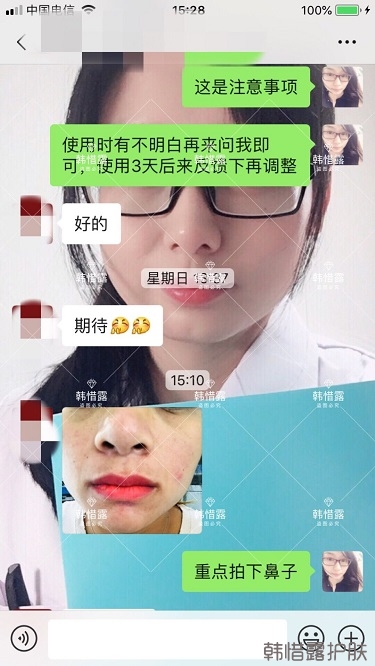 鼻子發(fā)紅長痘痘消了，皮膚吸收好就是任性！