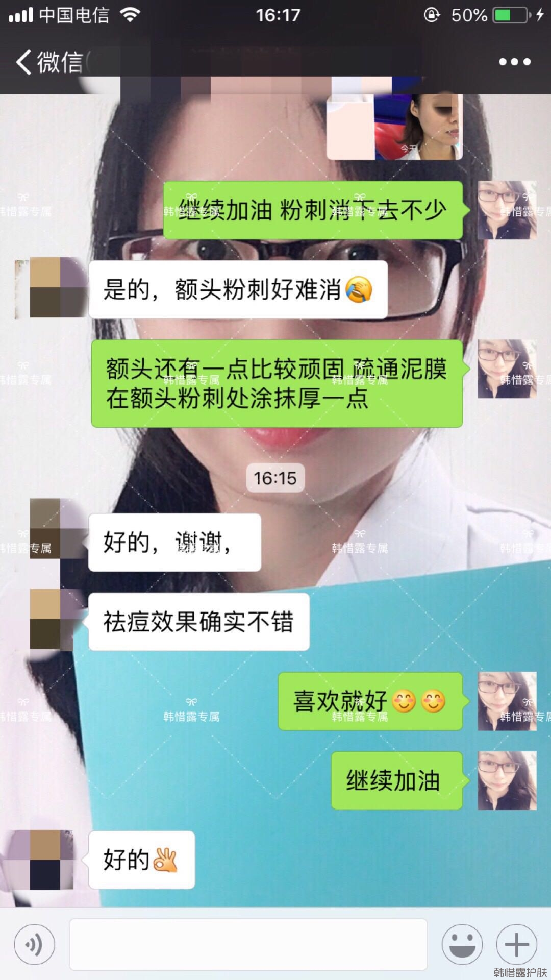 閉口粉刺怎么去除?嚴(yán)格按要求使用，粉刺效果不錯(cuò)！