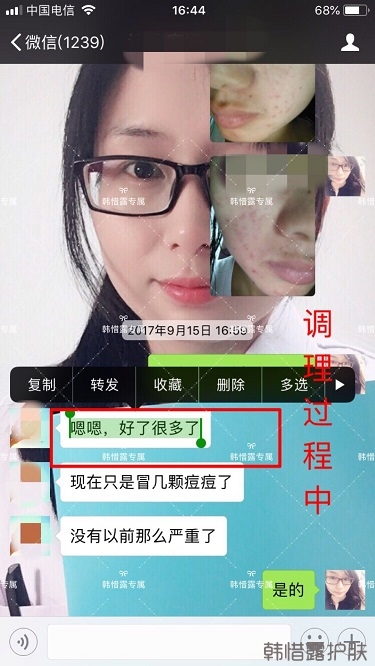 額頭長(zhǎng)痘臉頰長(zhǎng)痘痘粉刺，這樣調(diào)理幫你恢復(fù)嫩白肌膚！