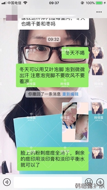 化妝品店主的變臉級祛痘反饋，粉刺痘痘全部消了