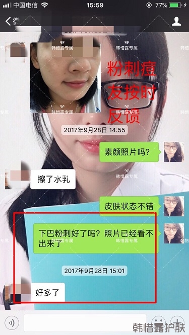 粉刺密密麻麻，試過很多方法無果后找韓惜露老師輕松去掉粉刺！