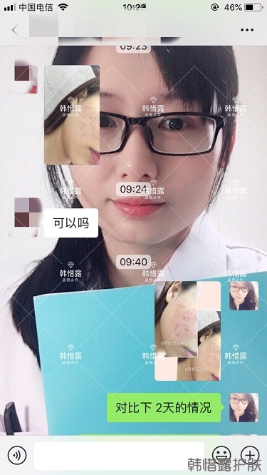 祛痘，痘痘發(fā)炎痘印就選它！