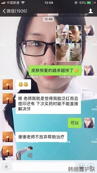 長痘痘找韓惜露，祛痘效果反饋