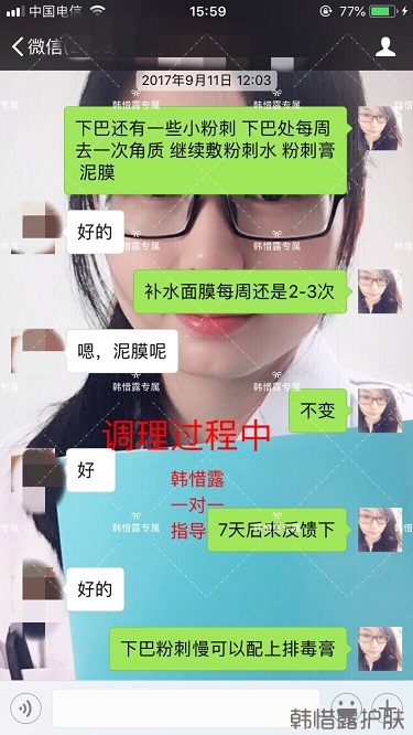 粉刺密密麻麻，試過很多方法無果后找韓惜露老師輕松去掉粉刺！